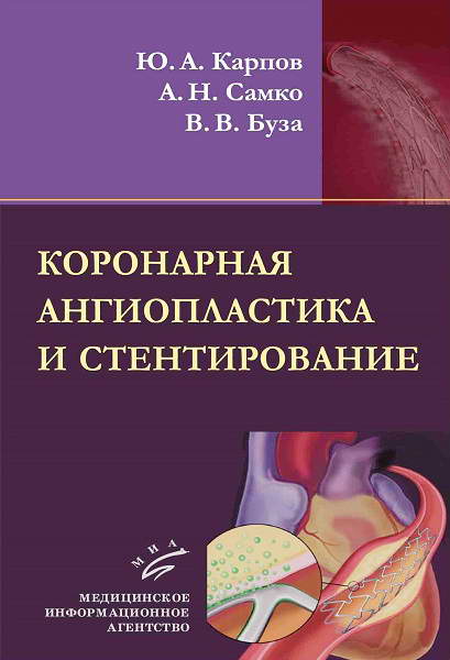 Karpov__Koronarnaja_angioplastika_i_stentirovanie